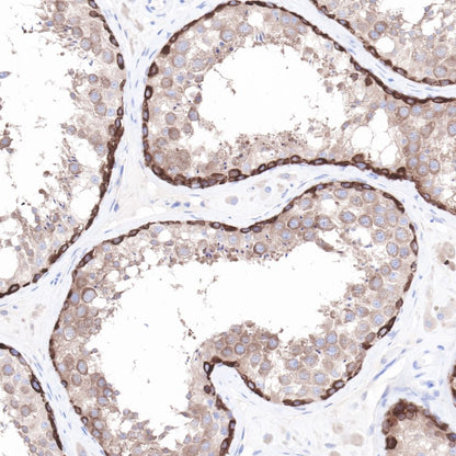 Hsp90 beta Recombinant Rabbit mAb (SDT-R033)