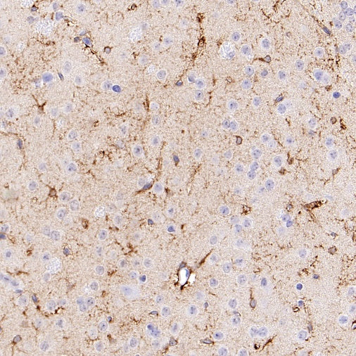 ALDH1L1 Recombinant Rabbit mAb (S-2885-49)