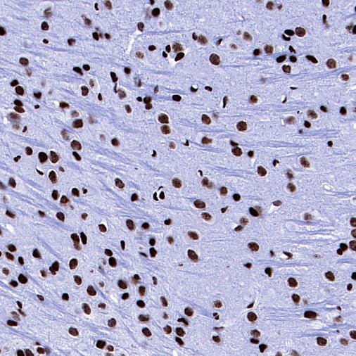 Histone H3 (acetyl K27) Recombinant Rabbit mAb (S-699-50)