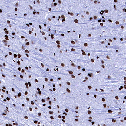 Histone H3 (acetyl K27) Recombinant Rabbit mAb (S-699-50)