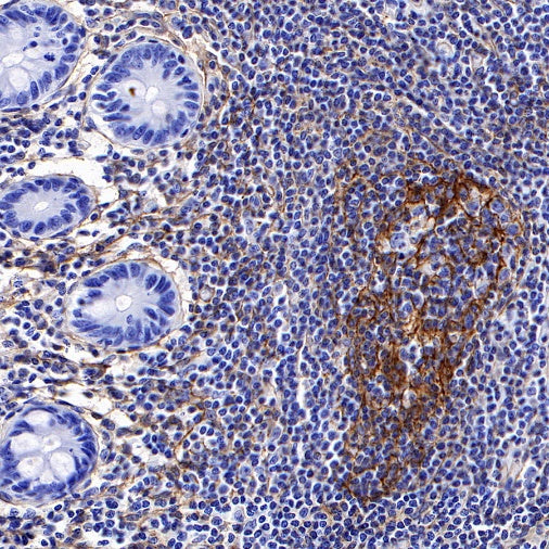 VCAM1 Recombinant Rabbit mAb (S-650-19)