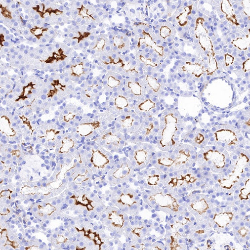 CSF-1R Recombinant Rabbit mAb (S-R219)