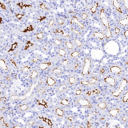 CSF-1R Recombinant Rabbit mAb (S-R219)