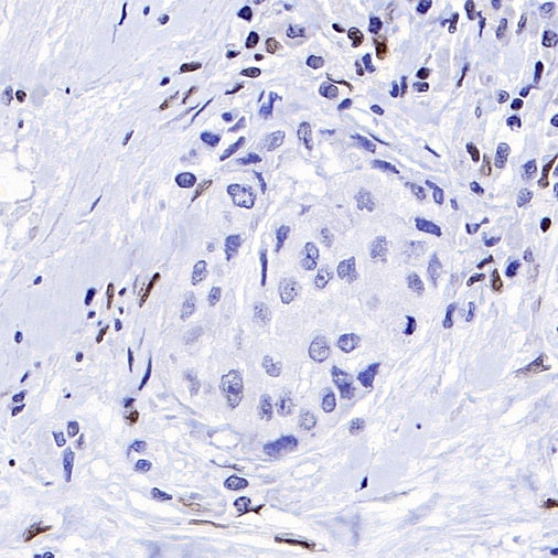 Runx2 Recombinant Rabbit mAb (S-1767-173)