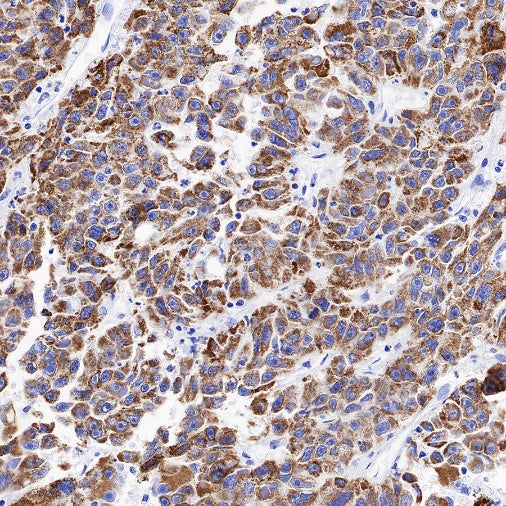 MAOA Rabbit Polyclonal Antibody