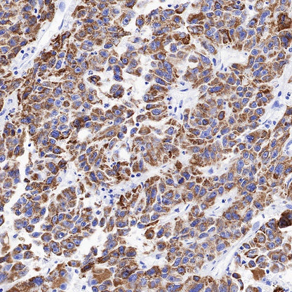 MAOA Rabbit Polyclonal Antibody