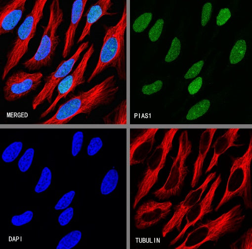 PIAS1 Recombinant Rabbit mAb (S-1430-7)