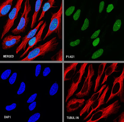 PIAS1 Recombinant Rabbit mAb (S-1430-7)
