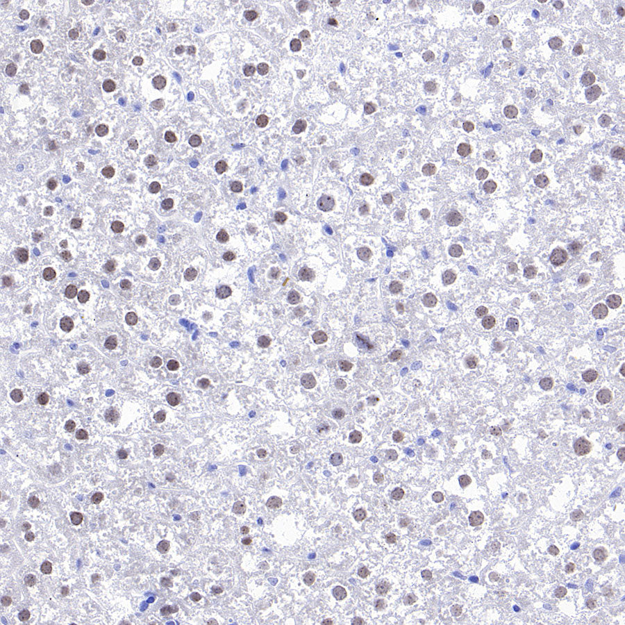 CEBPA Recombinant Rabbit mAb (S-3629-33)