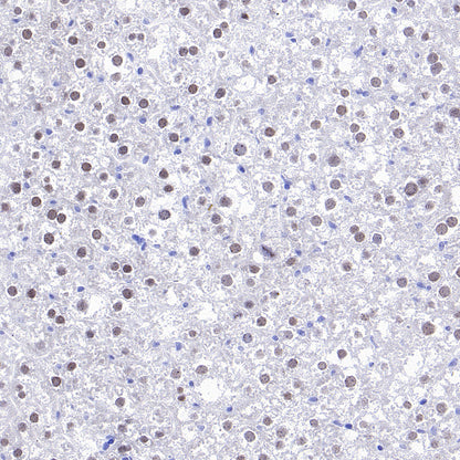 CEBPA Recombinant Rabbit mAb (S-3629-33)