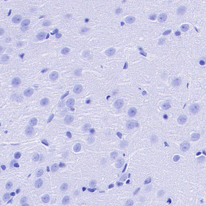 FSHB Recombinant Rabbit mAb (SDT-R287)