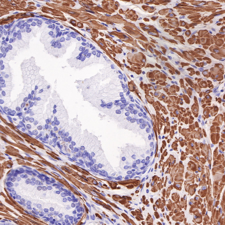 alpha smooth muscle Actin Recombinant Mouse mAb (SDT-R142)