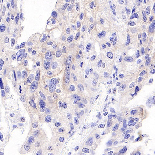 S-RMab® ErbB3 Recombinant Rabbit mAb (SDT-991-10)