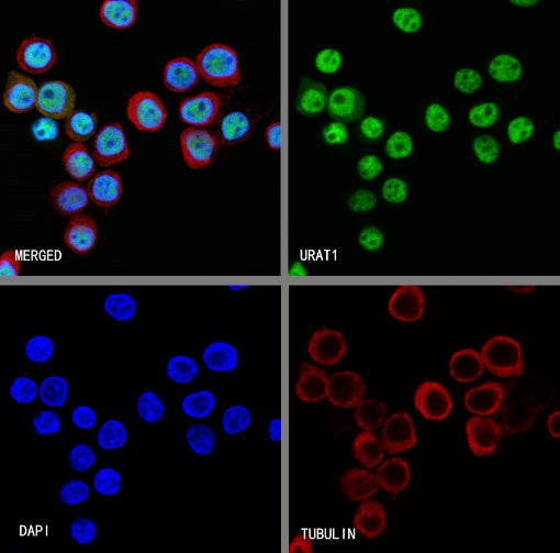 U2AF1 Recombinant Rabbit mAb (S-2384)