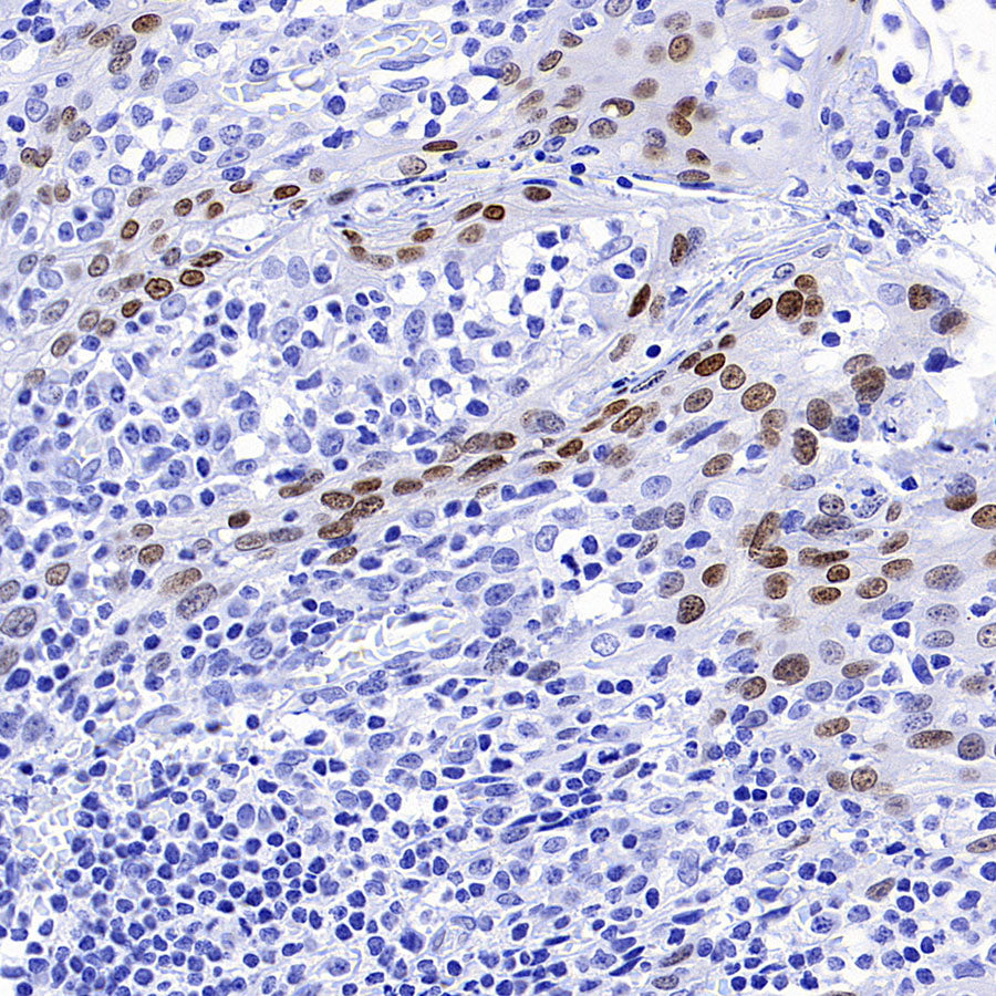 DLX3 Recombinant Rabbit mAb (S-4140-2)