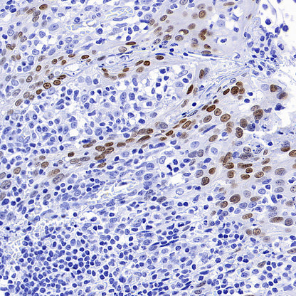 DLX3 Recombinant Rabbit mAb (S-4140-2)