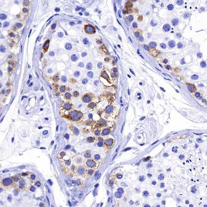 IMP-3 Recombinant Rabbit mAb (S-439-10)