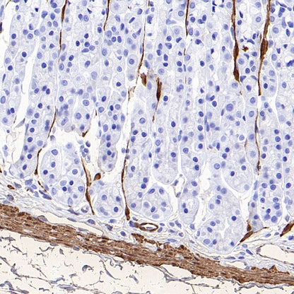 TAGLN/Transgelin Recombinant Rabbit mAb (S-1715-59)
