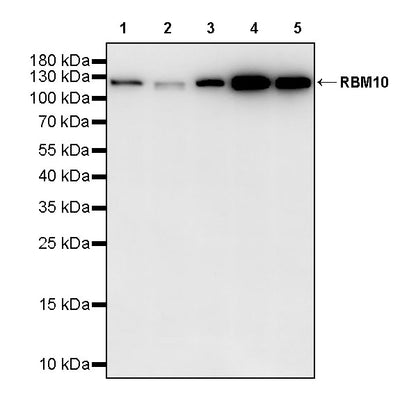 RBM10 Recombinant Rabbit mAb (S-4370-47)