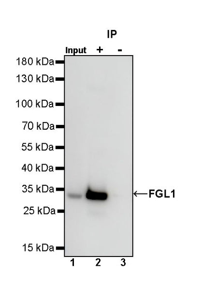 FGL1 Recombinant Rabbit mAb (S-1409-109)