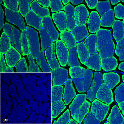 Alpha B Crystallin Recombinant Rabbit mAb (S-R216)
