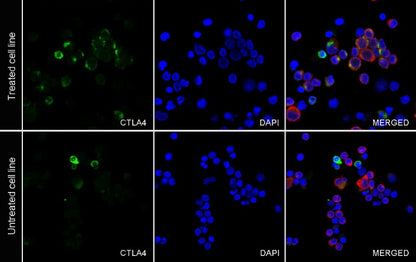 CTLA4 Recombinant Rabbit mAb (SDT-3348)