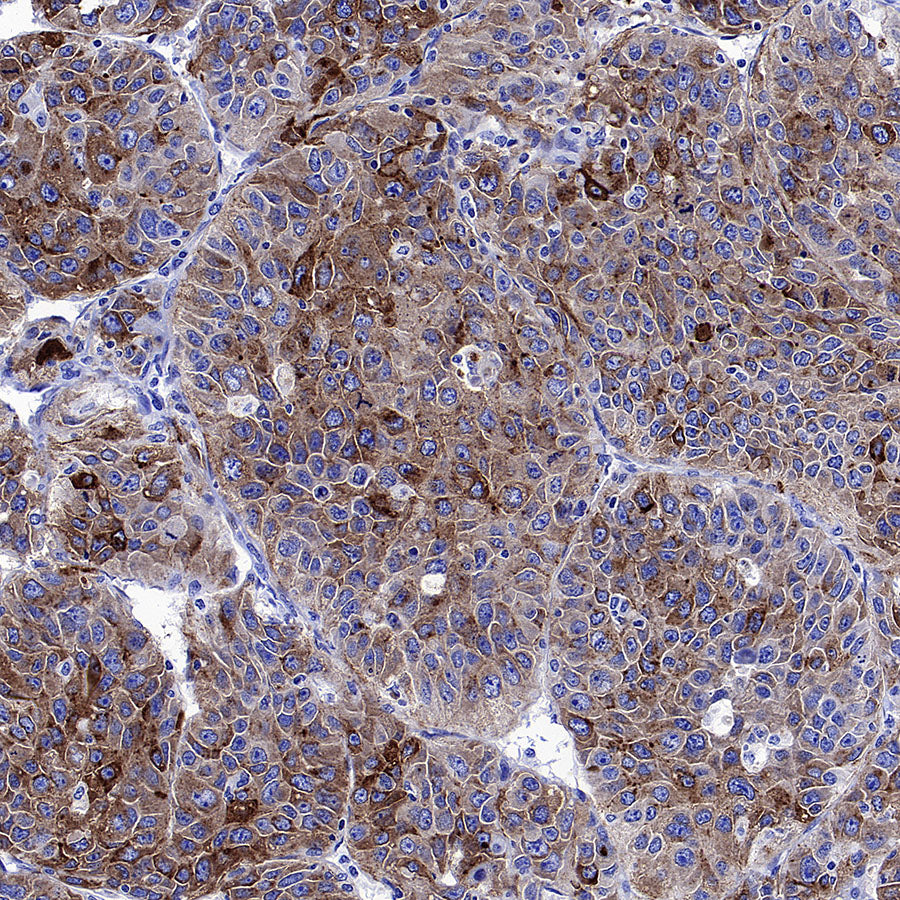 Glypican-3 Recombinant Rabbit mAb (SDT-4064-69)
