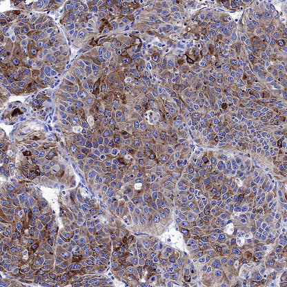 Glypican-3 Recombinant Rabbit mAb (SDT-4064-69)