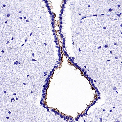 ARL13B Recombinant Rabbit mAb (S-2113-11)