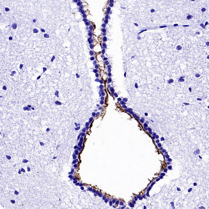 ARL13B Recombinant Rabbit mAb (S-2113-11)
