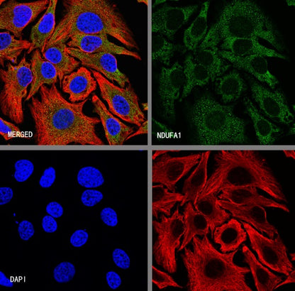 NDUFA1 Recombinant Rabbit mAb (S-1277-177)