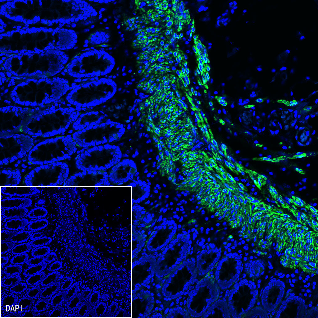 Calponin-1 Recombinant Rabbit mAb (S-R161)