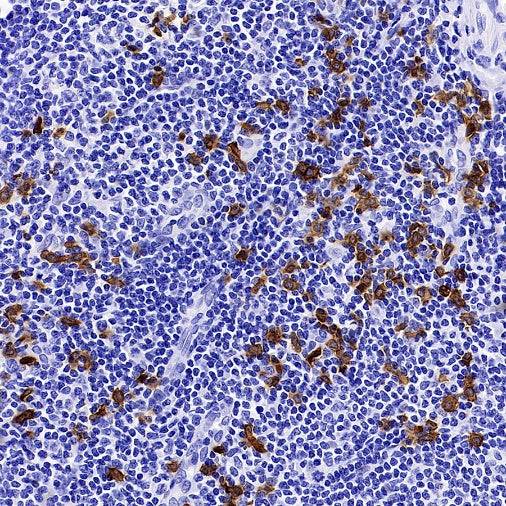 CLEC4C Recombinant Rabbit mAb (S-3825)