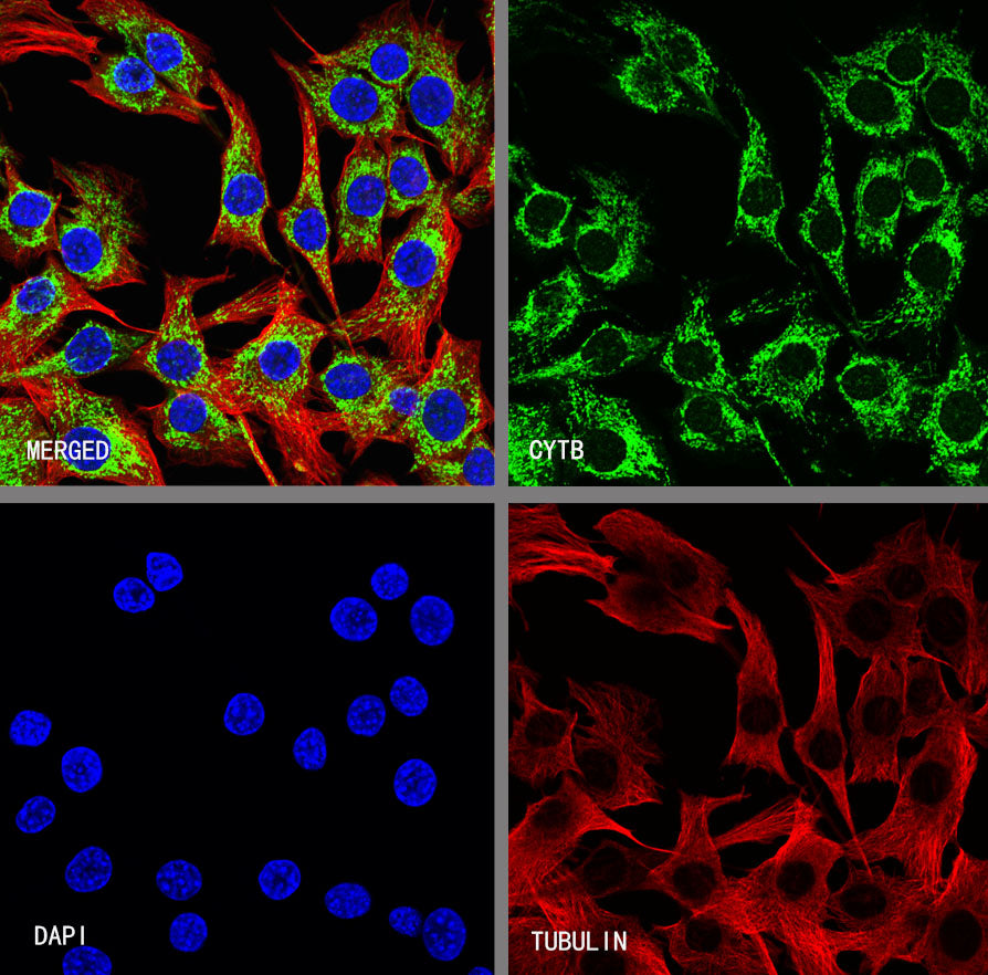 CYTB Recombinant Rabbit mAb (S-3877-15)