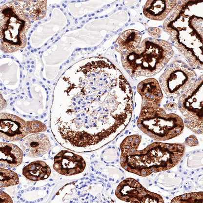 CD13 Recombinant Rabbit mAb (SDT-R162)