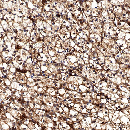 Glutathione Peroxidase 1 Recombinant Rabbit mAb (S-1714-17)