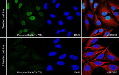 Phospho-Stat3 (Tyr705) Recombinant Rabbit mAb (S-515-360)