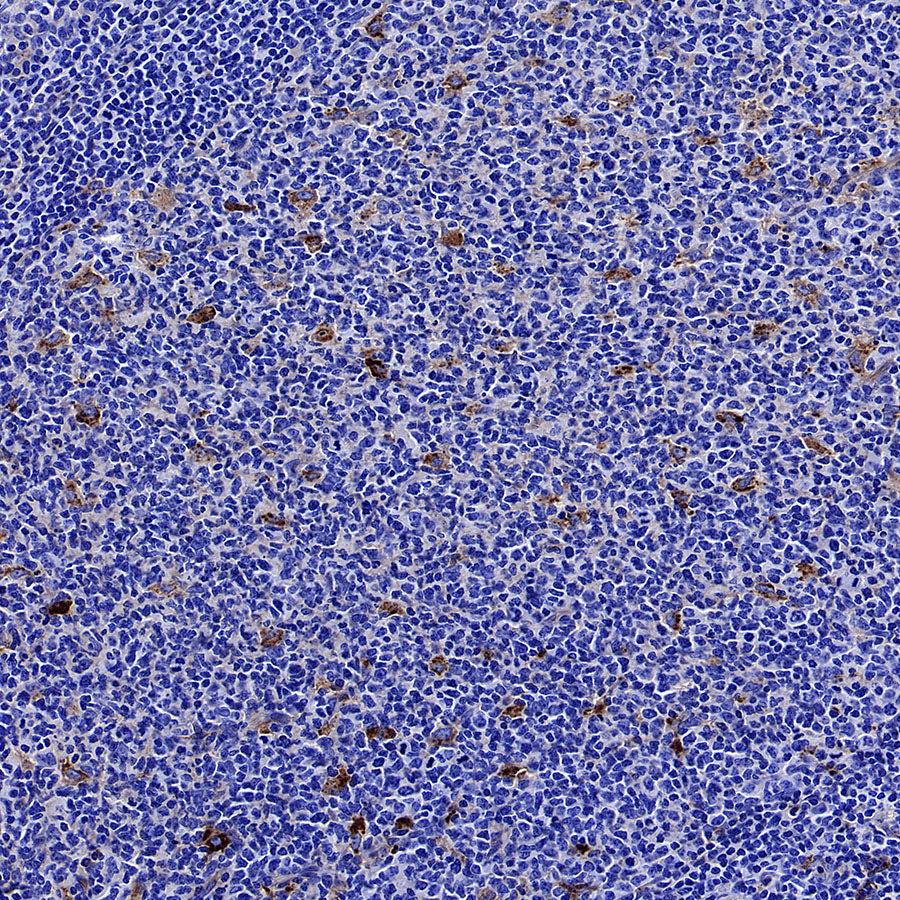 CD151 Recombinant Rabbit mAb (S-3235-104)