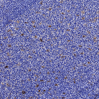CD151 Recombinant Rabbit mAb (S-3235-104)