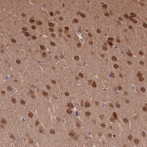 DYNLL1/PIN Recombinant Rabbit mAb (S-1460-8)