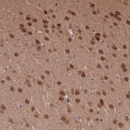 DYNLL1/PIN Recombinant Rabbit mAb (S-1460-8)