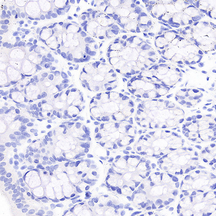 MOG Rabbit Polyclonal Antibody