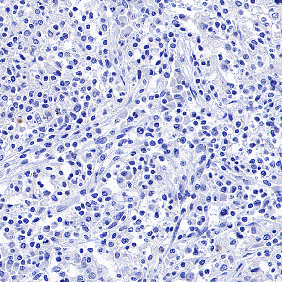 NeuroD1 Recombinant Rabbit mAb (SDT-3843-59)
