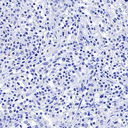 NeuroD1 Recombinant Rabbit mAb (SDT-3843-59)