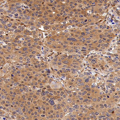 Dctd Recombinant Rabbit mAb (S-4313-16)