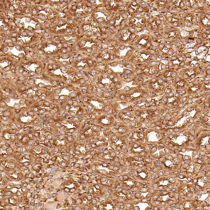 PABP Recombinant Rabbit mAb (S-1744-42)