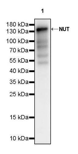 NUT Recombinant Rabbit mAb (SDT-3062)