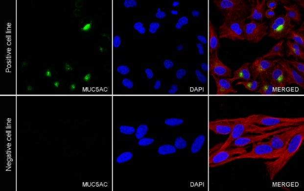 MUC5AC Recombinant Rabbit mAb (SDT-2630-23)