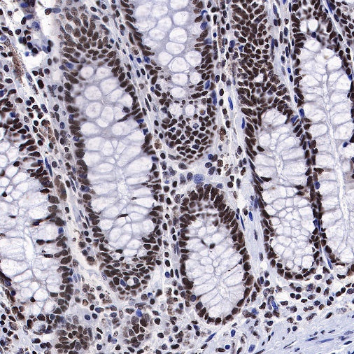 FUBP1 Recombinant Rabbit mAb (S-739-21)