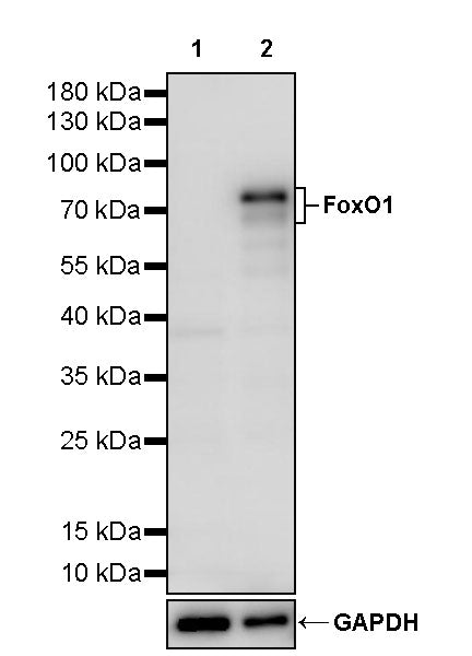 FoxO1 Recombinant Rabbit mAb (S-5118)